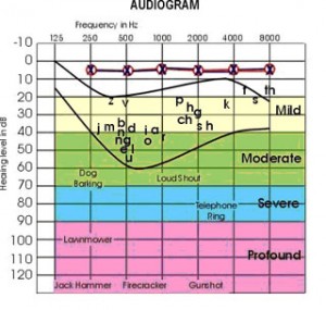 Audiogram Chart